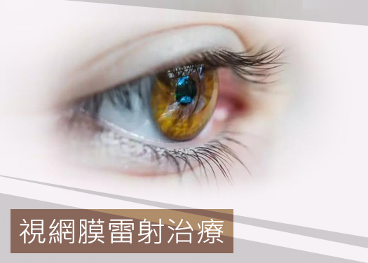 視網膜雷射治療